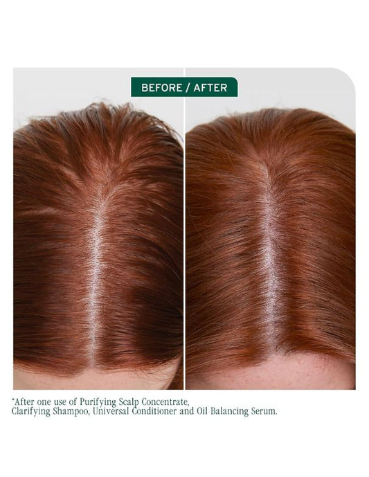 Biolage Scalp Sync Clarifying Shampoo - 1L