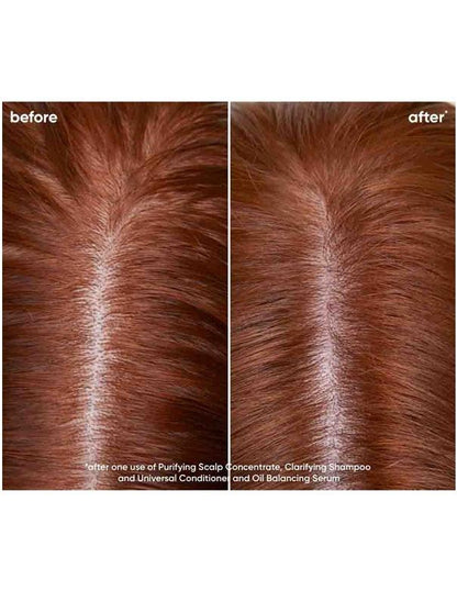 Matrix Biolage Scalp Sync Clarifying Shampoo - 400ml