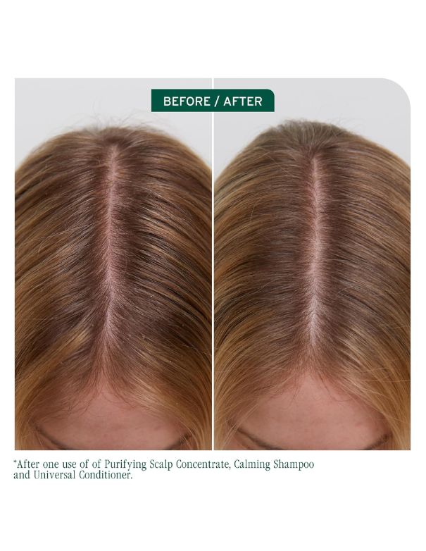 Biolage Scalp Sync Universal Conditioner - 1L