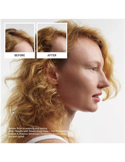 Shampoing Nioxin System 4 pour cuir chevelu et cheveux - 300 ml